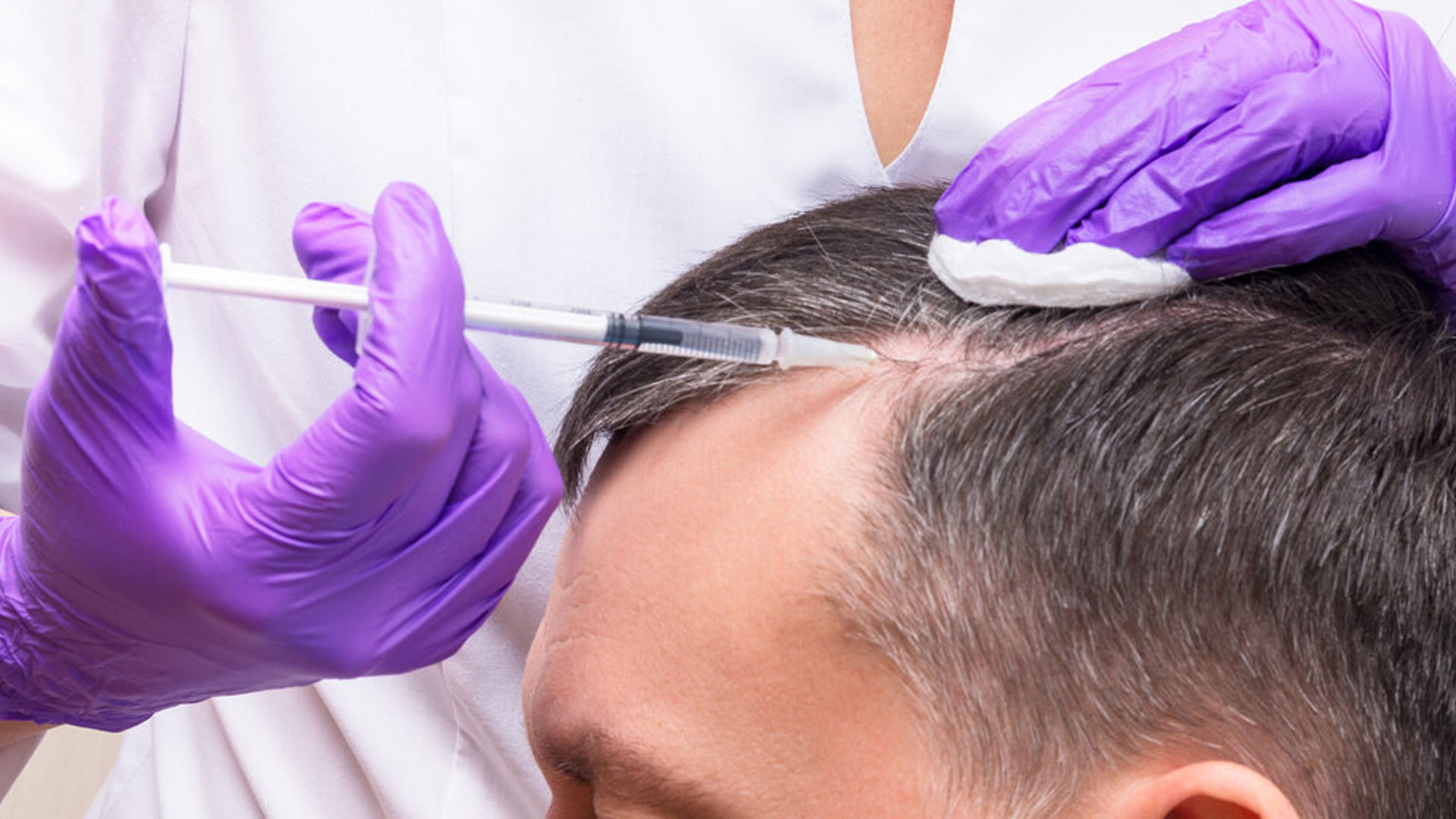 Hair Restoration Innovation Health